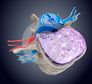 Spinal cord under pressure of bulging disc