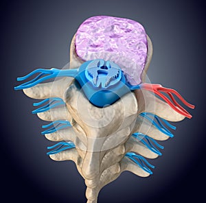 Spinal cord under pressure of bulging disc