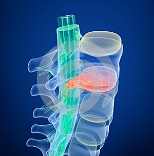 Spinal cord under pressure of bulging disc. Medically accurate 3D illustration