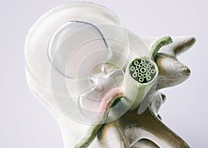 Spinal disc herniation as close-up as 3D Rendering