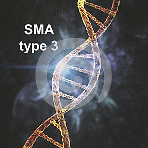 Spinal muscular atrophy, SMA, a genetic neuromuscular disorder
