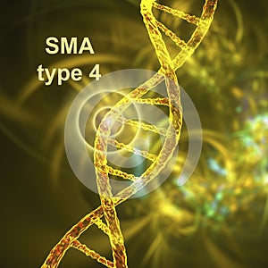 Spinal muscular atrophy, SMA, a genetic neuromuscular disorder