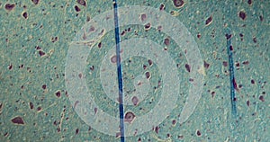 Spinal nerves of the rat in cross section