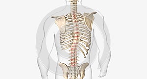 The Spinal scoliosis and kyphosis photo