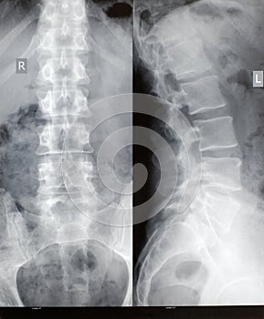 Columna vertebral a página verticalmente de cerca 