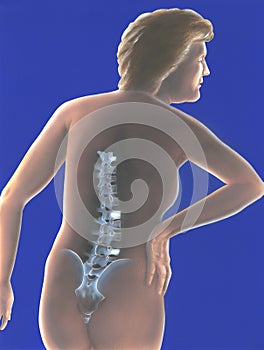 Spine - Back Pain
