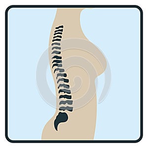 Spine backbone bone, x-ray concept icon, roentgen human body image isolated on white, flat vector illustration. Skeleton part of