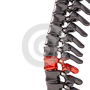 Spine with glass vertebrae. fragility concept