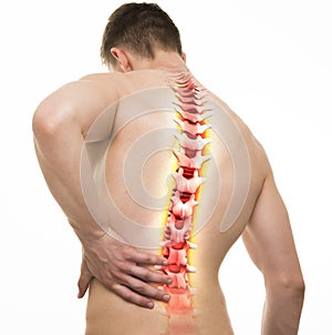 Spine Injury - Studio shot with 3D illustration isolated on whit