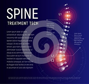 Spine injury treatment, xray human back, healthcare infographic, spinal pain vector illustration.