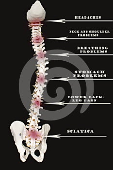 Spine Labeled by Areas Affected photo