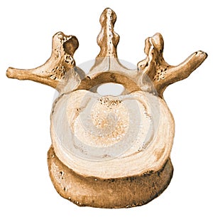 Spine - Lumbar Vertebra photo