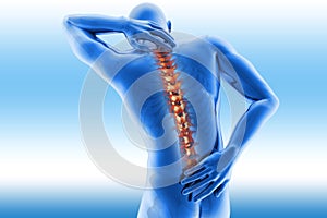 Spine pain - vertebrae trauma photo