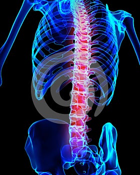 Spine painful skeleton x-ray, 3D illustration.