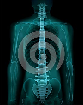 Spine X-Ray Realistic Image