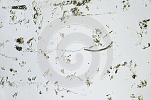 Spirochete, spiral bateria in the center of the photo photo