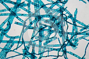 Spirogyra alga under the microscope