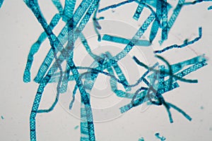 Spirogyra alga under the microscope