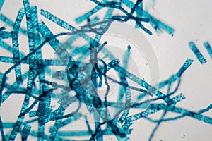 Spirogyra alga under the microscope