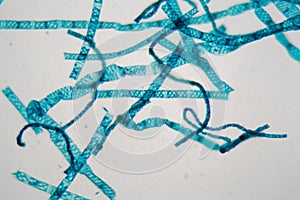 Spirogyra alga under the microscope