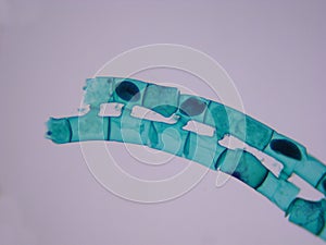 Spirogyra conjugation