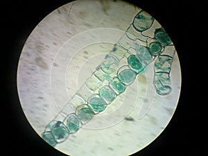 Spirogyra conjugation