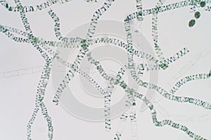 Spirogyra is genus of filamentous charophyte green algae