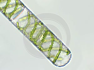 Spirogyra sp. algae under microscopic view x40 - Chlorophyta