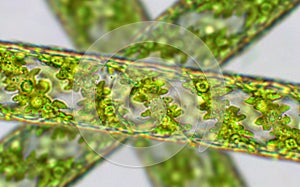 Spirogyra sp. green algae under microscopic view - Chlorophyta, Green algae