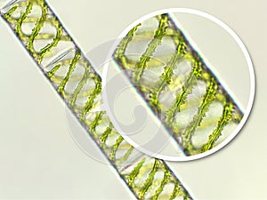 Spirogyra sp. green algae under microscopic view x40 - Chlorophyta