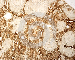 Spleen macrophages. Acid phosphatase photo