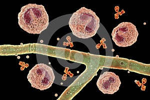 Splendore-Hoeppli phenomenon, 3D illustration. Eosinophilic reaction around the invading fungal hyphae in human tissues