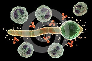 Splendore-Hoeppli phenomenon, 3D illustration. Eosinophilic reaction around the invading fungal hyphae in human tissues