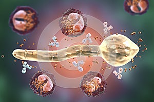 Splendore-Hoeppli phenomenon, 3D illustration. Eosinophilic reaction around the invading fungal hyphae in human tissues