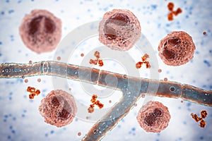 Splendore-Hoeppli phenomenon, 3D illustration. Eosinophilic reaction around the invading fungal hyphae in human tissues