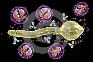 Splendore-Hoeppli phenomenon, 3D illustration. Eosinophilic reaction around the invading fungal hyphae in human tissues photo