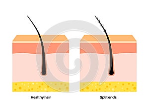 Split and normal hair