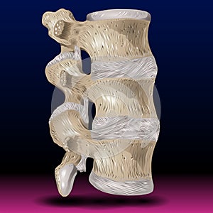 Spondylitis - Human Anatomy - Healthcare - Science