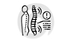 spondyloarthropathies health problem line icon animation