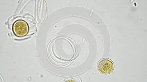 Spore of Equisetum arvense whole mount under miscroscope 200x on bright field