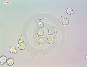 Spores of the Tawny Grisette