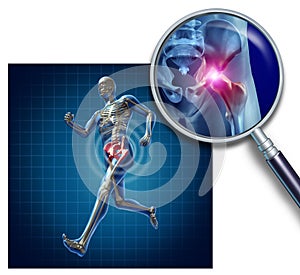 Sports Hip Injury