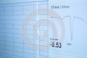 Sports performance fitness endurance evaluation test gas analysis