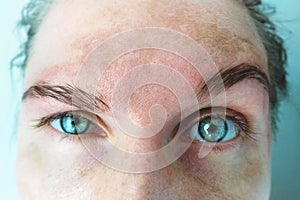 Místo pigmentace obličejový léčba na žena. péče o pleť a. mladá žena kůže 