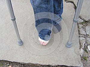 Sprained Ankle & Crutches