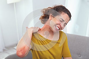 Young infected lady experiencing a spreading skin rash photo