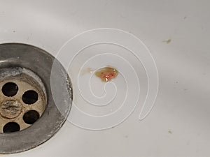 Sputum or saliva with blood in the sink photo