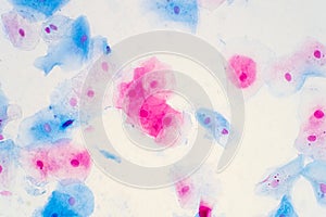 Squamous epithelial cells of human cervix under microscope view