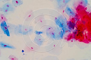 Squamous epithelial cells under microscope view for education hi