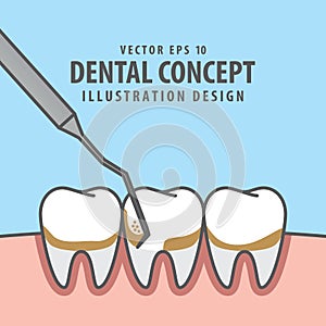 Square banner Scaling teeth illustration vector on blue backgrou